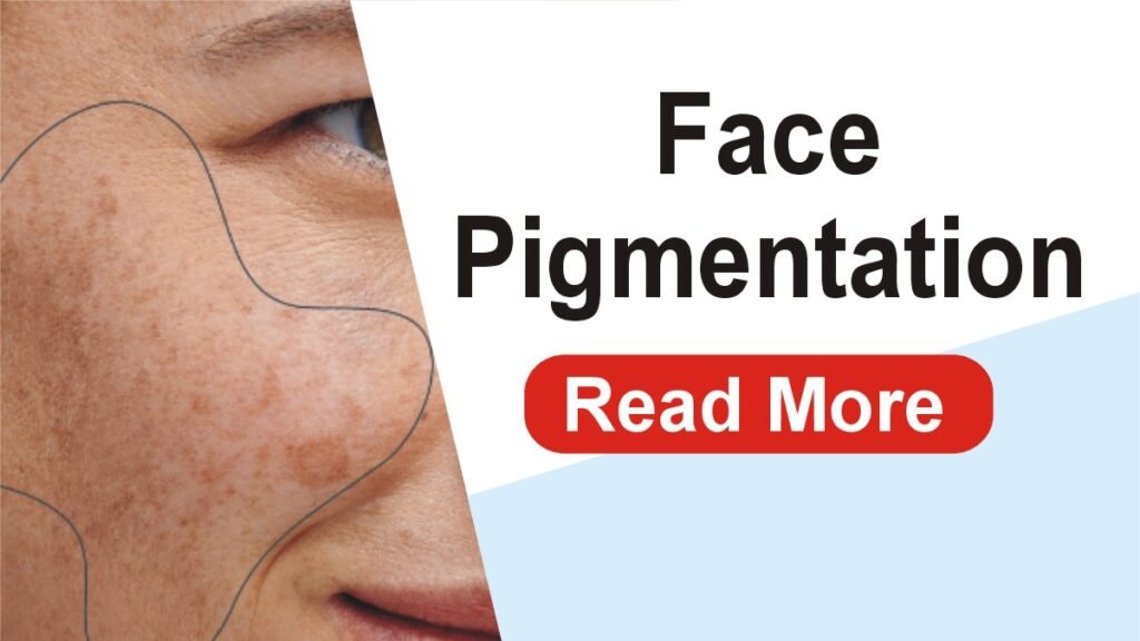 Face Pigmentation – Causes, Treatment, and Expert Tips